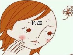 嘴角周围的原因是什么痘痘